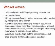 Image result for Wicket Waves