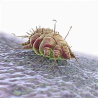 Image result for A Beautiful Picture of Scabies Bug