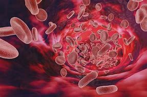 Image result for anemia