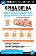 Image result for Spina Bifida Symptoms