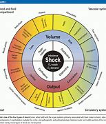 Image result for 4 Types of Shock