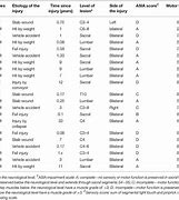 Image result for Sharpness Test Chart