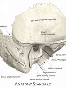 Image result for Temporal Bone