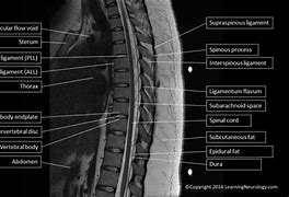 Image result for Dorsal Spine View