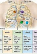 Image result for S1 S2 Heart Sounds