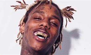 Image result for Famous Dex Missing Teeth