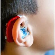 Image result for Pediatric Hearing Aids