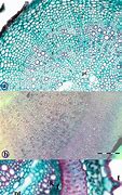 Image result for Difference Between Xylem and Phloem