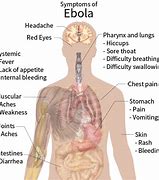 Image result for Ebola PNG