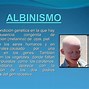 Image result for albibismo
