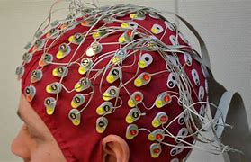 Image result for EEG Functional Connectivity
