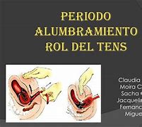 Image result for alarhamiento
