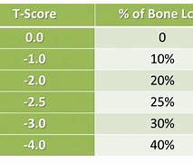 Image result for Bone Density Score Chart