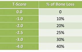 Image result for Bone Mass Chart