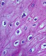 Image result for Verruca Vulgaris Pathology