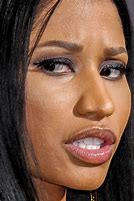 Image result for Nicki Minaj Yellow Plaque Teeth