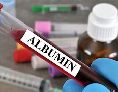 Image result for albumin�me6ro