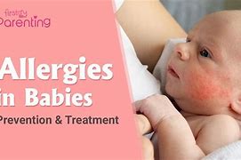 Image result for Baby Allergies