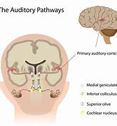 Image result for Primary Auditory Cortex