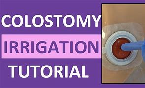 Image result for Ostomy Armor