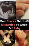 Image result for What Do Early Miscarriages Look Like