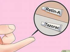 curare l acne dall interno 3 modi per curare velocemente l acne intorno alle labbra curare l acne dall interno 3 modi per curare velocemente l acne intorno alle labbra