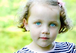 Image result for Smallest Eyes in the World