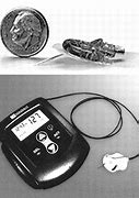 Image result for Medtronic Continuous Glucose Monitor