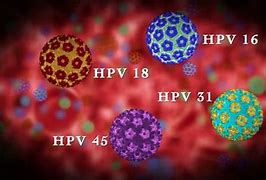 Image result for HPV STD