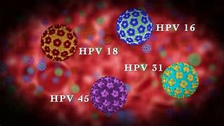 Image result for Human Papillomavirus HPV Signs and Symptoms