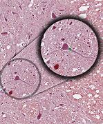 Image result for Neuron Axon Hillock Microscope