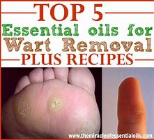Image result for Essential Oils for Warts