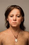 Image result for Homozygous Person