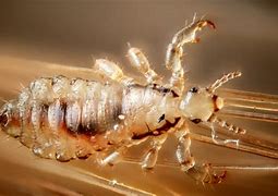 Image result for Lice Bug