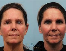 Image result for Cosmetic Surgery Procedure