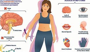 Image result for ataxia