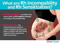 Image result for RH Negative and Pregnancy Hand Out