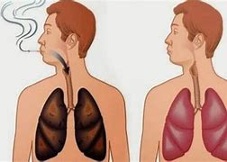 Image result for Tar Coats Lungs