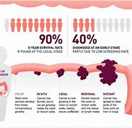 Image result for Stages of Colon Cancer Symptoms