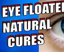 Image result for Eye Floaters Solution