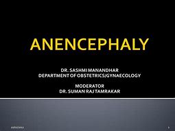 Image result for Anencephaly Folic Acid