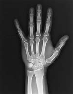 Image result for Hand X Ray Poster
