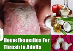 Image result for Molluscum Contagiosum Treatments for Adults