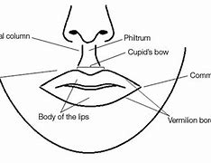 Image result for Wart On My Lip