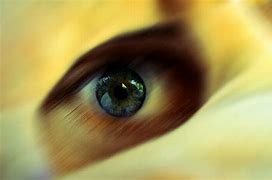 Image result for Blurred Vision One Eye