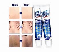 Image result for Wart Removal Cream India