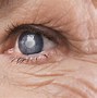 Image result for Eyes Blurry After Eye Drops