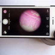 Image result for Smartphone Microscope Lens Yeast and Mold