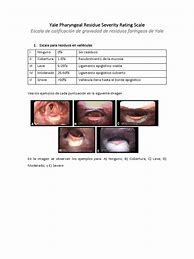 Image result for Cvai Severity Chart