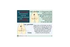 psoriasi alimentazione consigliata cisti sebacea infiammata e suppurata cause terapia e psoriasi alimentazione consigliata cisti sebacea infiammata e suppurata cause terapia e